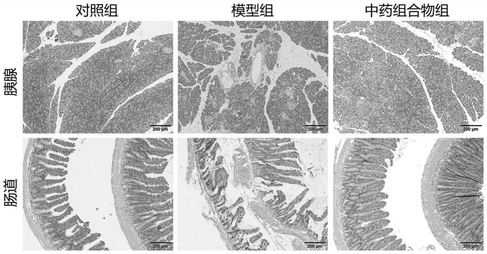 Traditional Chinese medicine composition for treating acute pancreatitis and application thereof