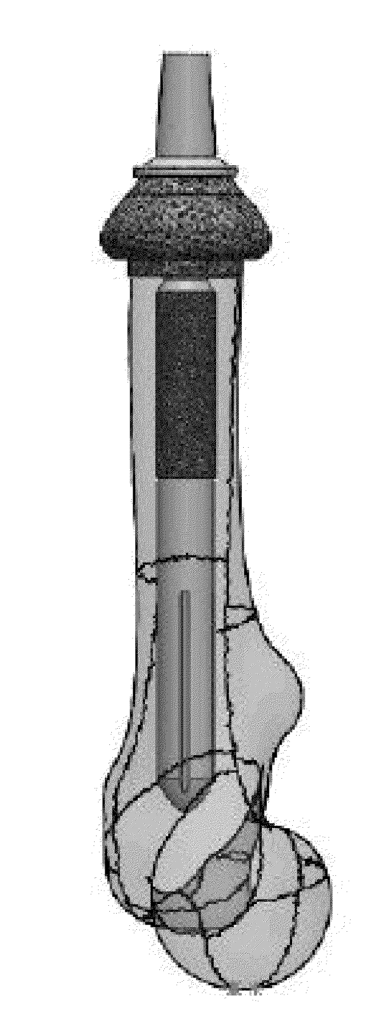 Transcutaneous Implant for Skeletal Attachment of External Prosthetic Devices