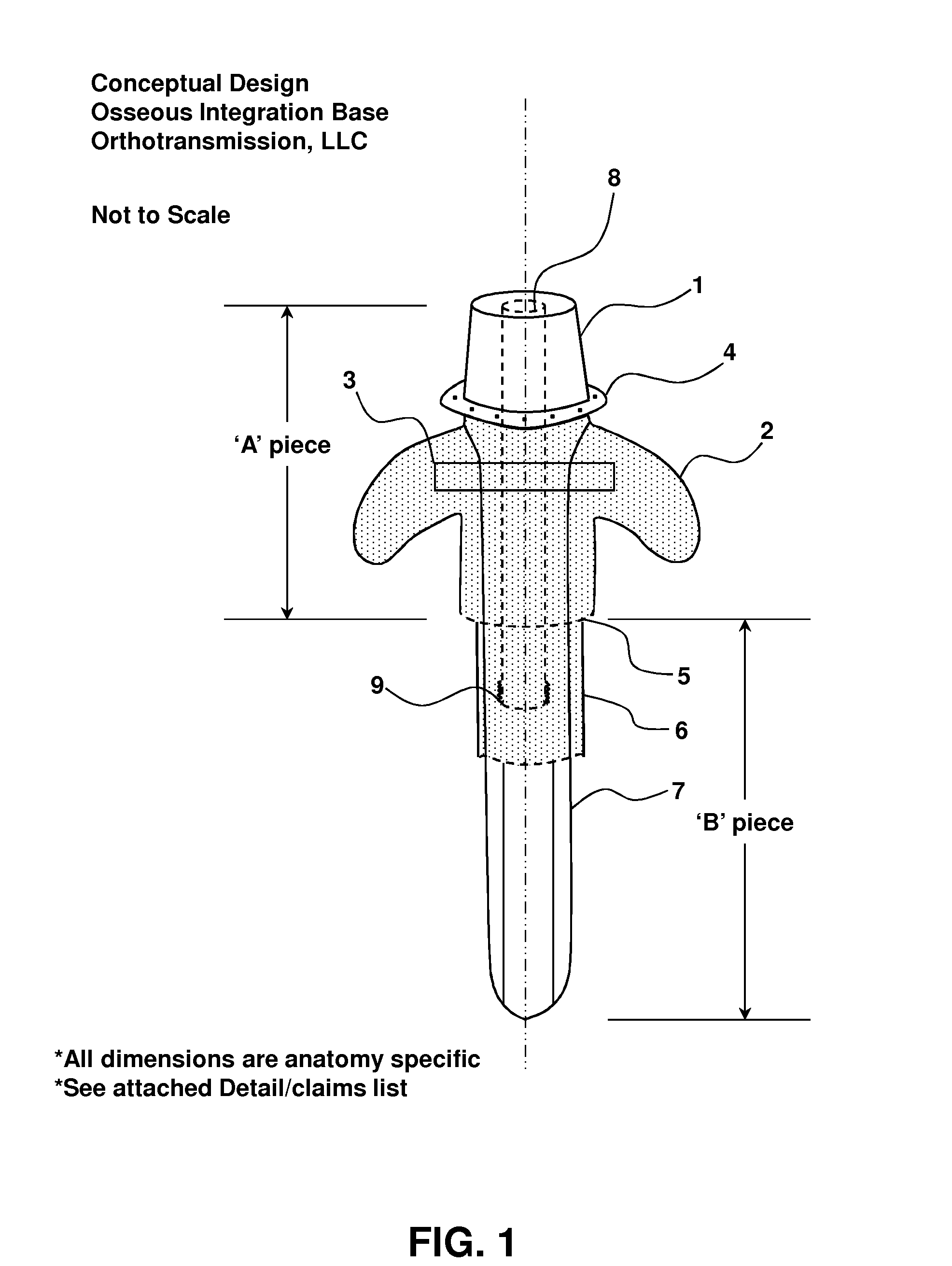 Transcutaneous Implant for Skeletal Attachment of External Prosthetic Devices