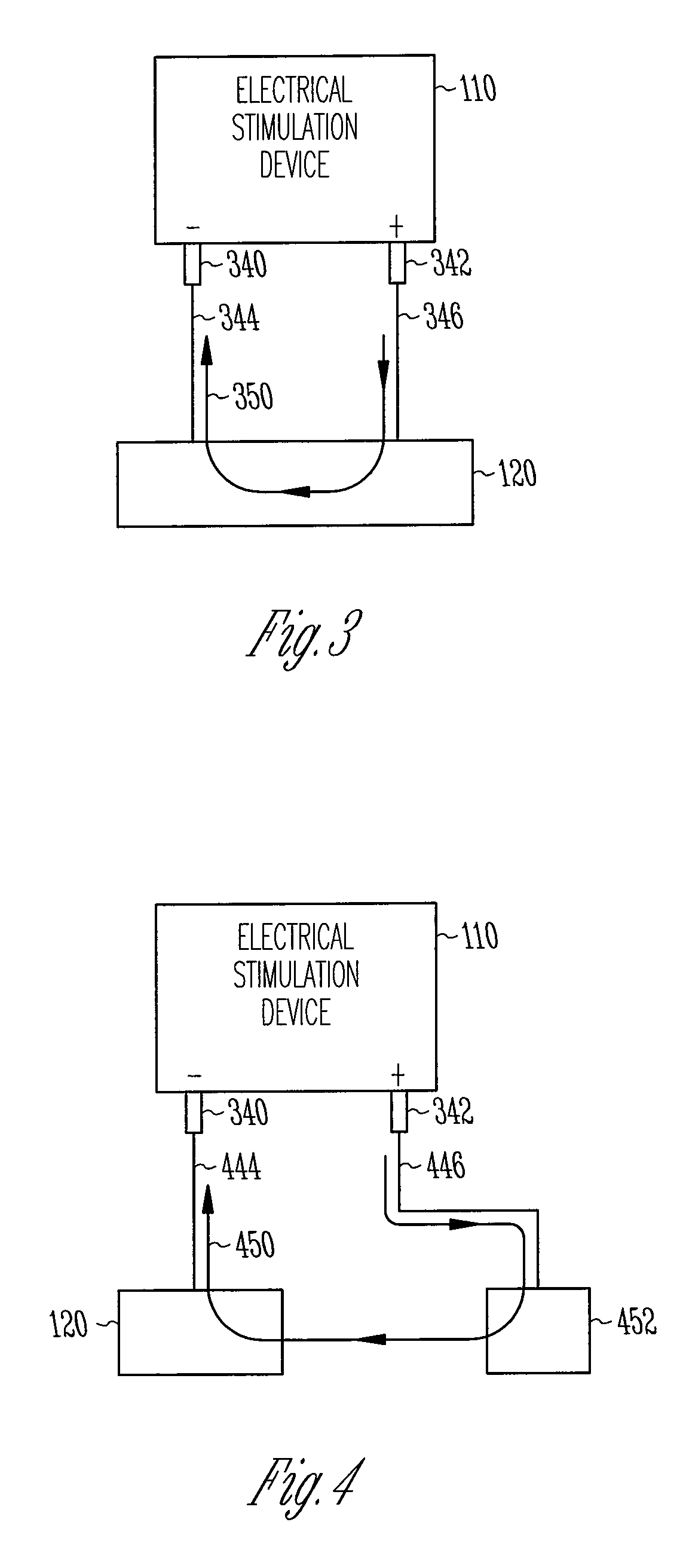 Electrically conducting scaffolds for cell-based pacing