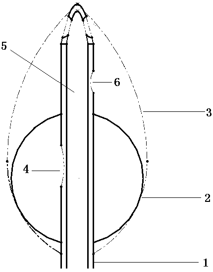 Bladder irrigation anti-clog catheter