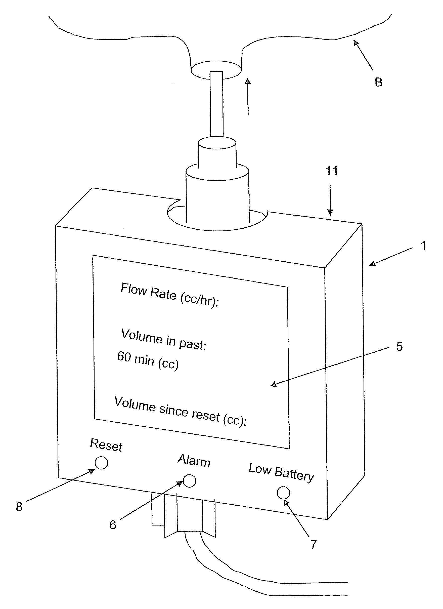 Automated intravenous monitoring device