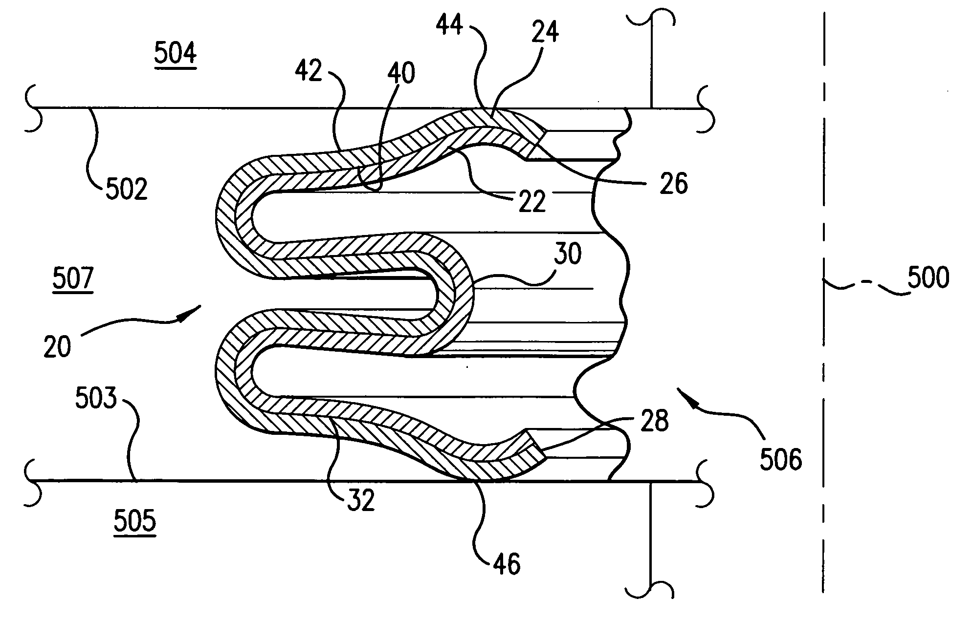 High temperature metallic seal