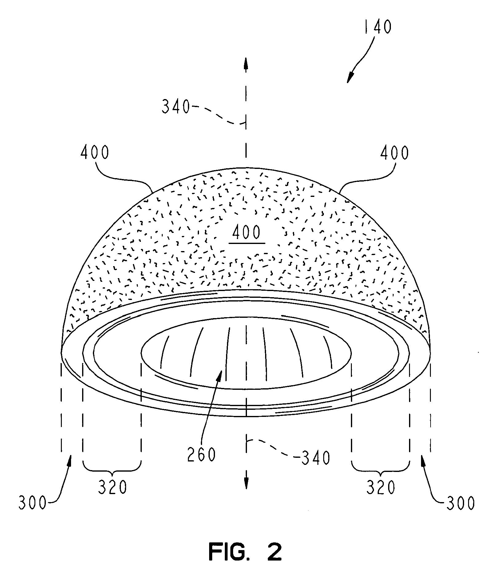 Method for making a metal-backed acetabular implant