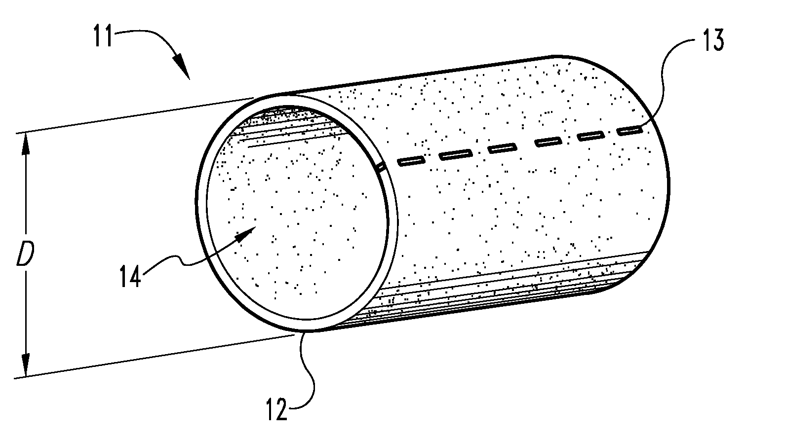 Graft prosthesis, materials and methods