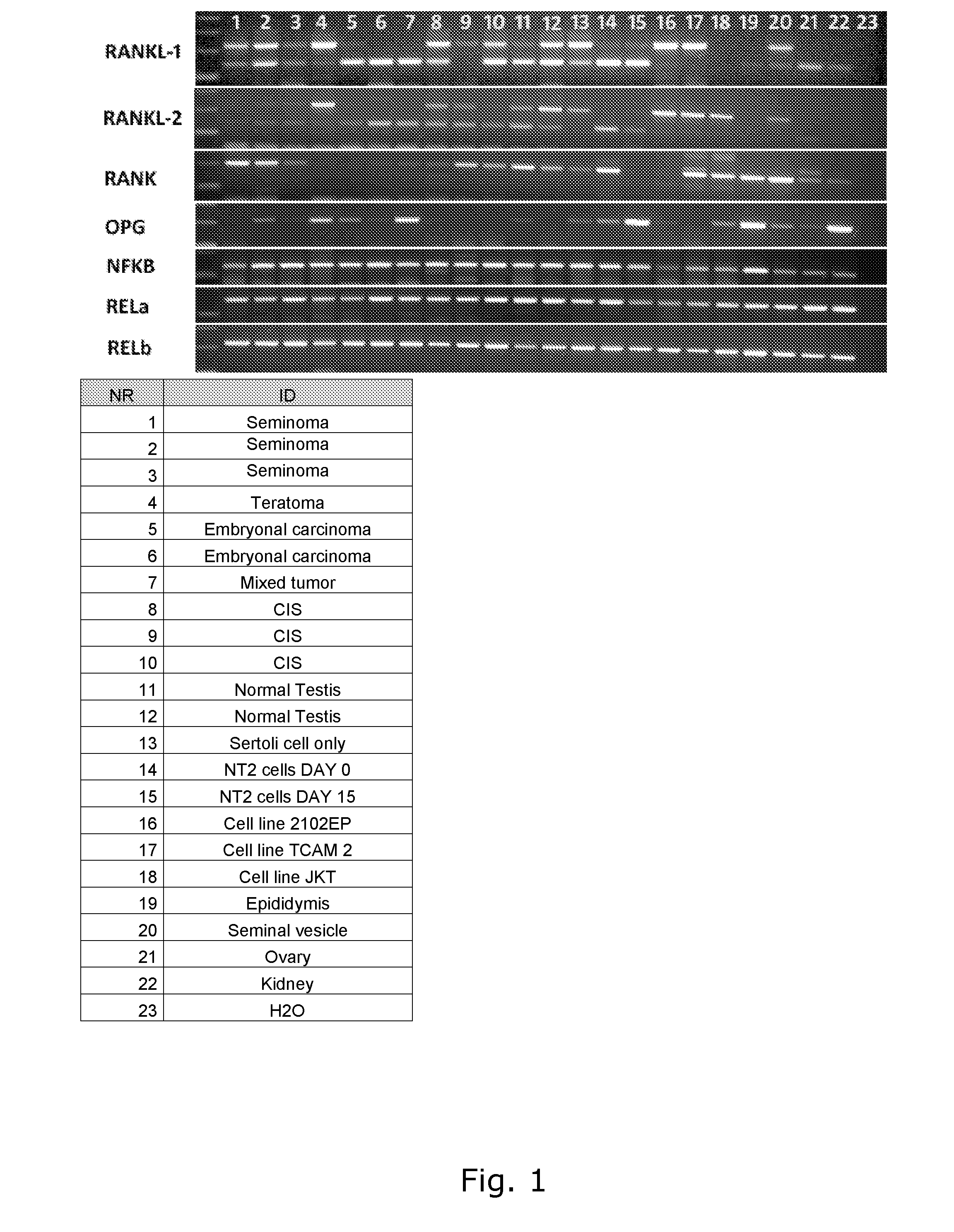 Antibodies, compounds and derivatives thereof for use in the treatment of male infertility