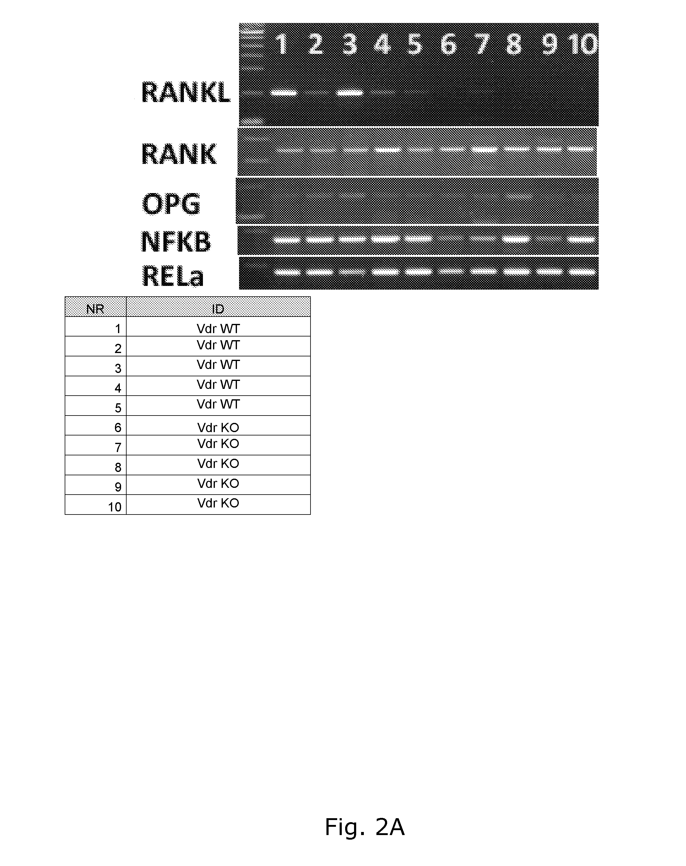 Antibodies, compounds and derivatives thereof for use in the treatment of male infertility