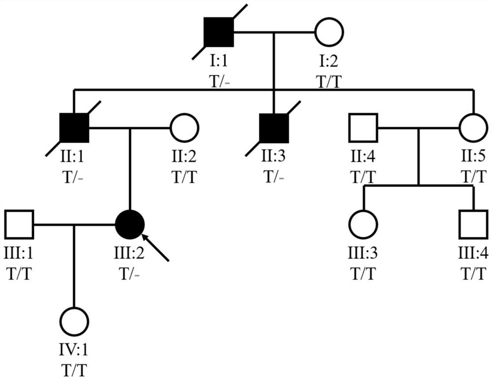 Pathogenic gene of hypertrophic cardiomyopathy and application thereof