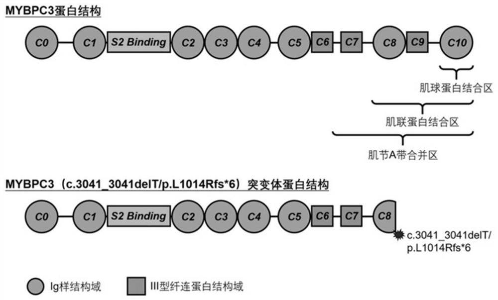 Pathogenic gene of hypertrophic cardiomyopathy and application thereof