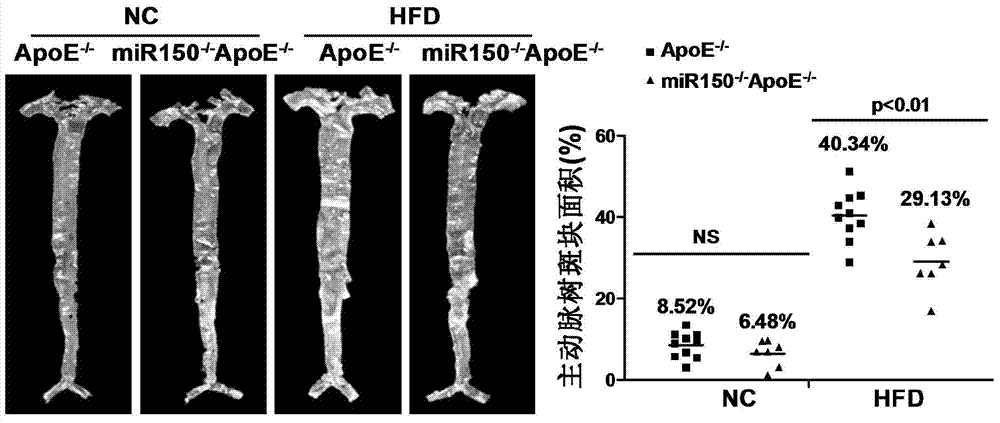 Function and application of microRNA150 in treatment of atherosclerosis