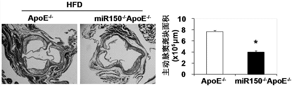 Function and application of microRNA150 in treatment of atherosclerosis