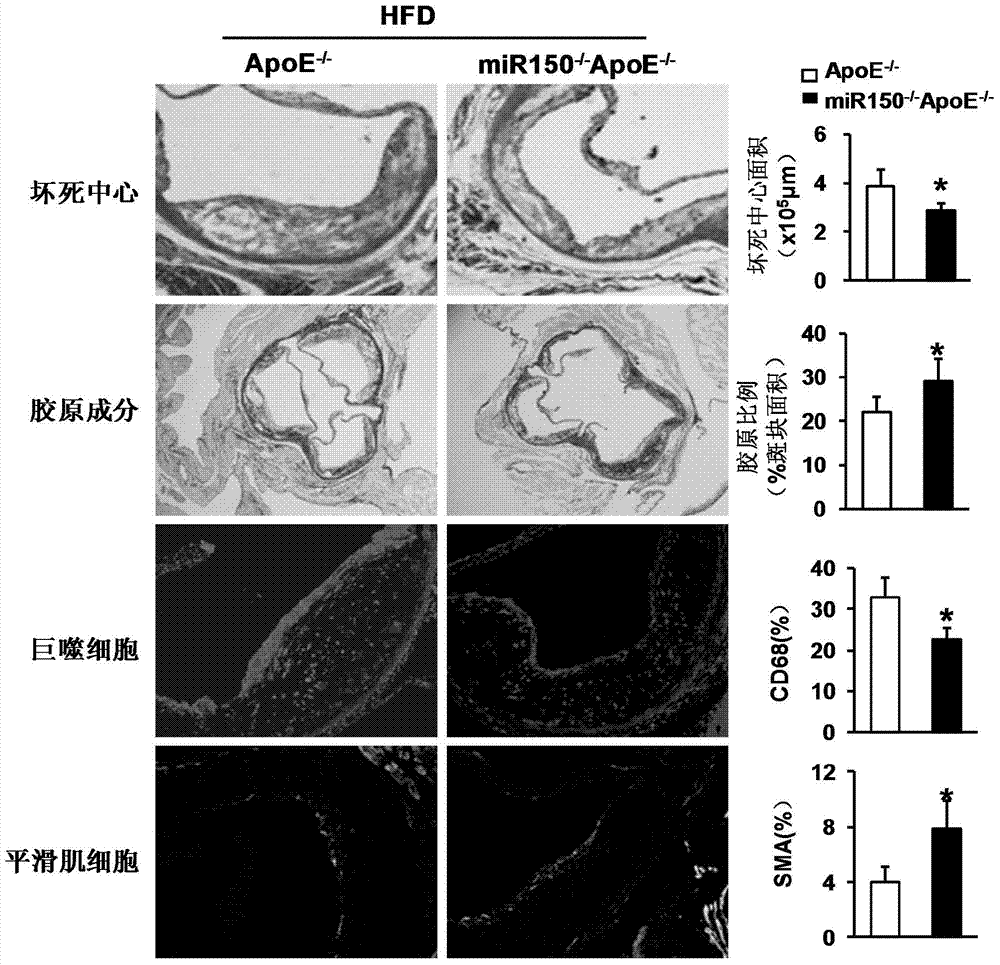 Function and application of microRNA150 in treatment of atherosclerosis