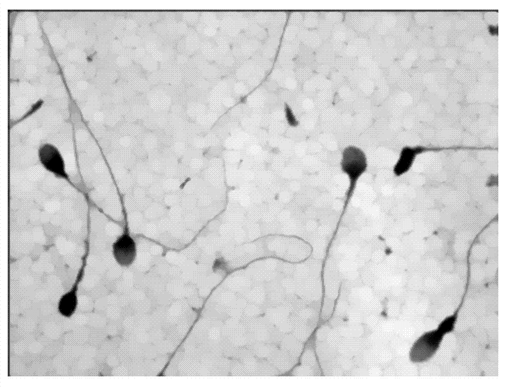 Sperm morphology anomaly detection method