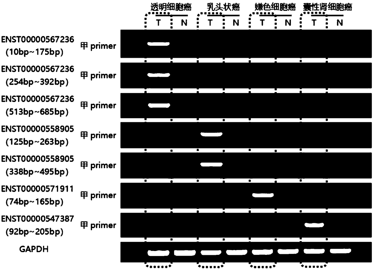 Gene detection kit for detecting chromophobe cell carcinoma subtype in renal carcinoma