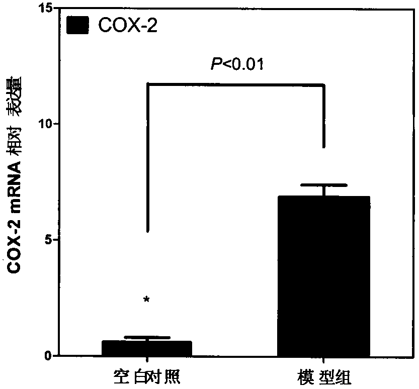 Kit for separating RNA (ribonucleic acid) bound in RNA binding protein