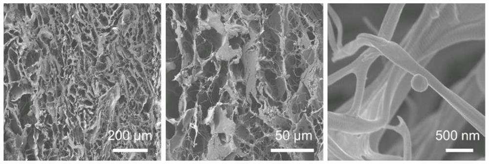 Preparation method of acellular dermal matrix material