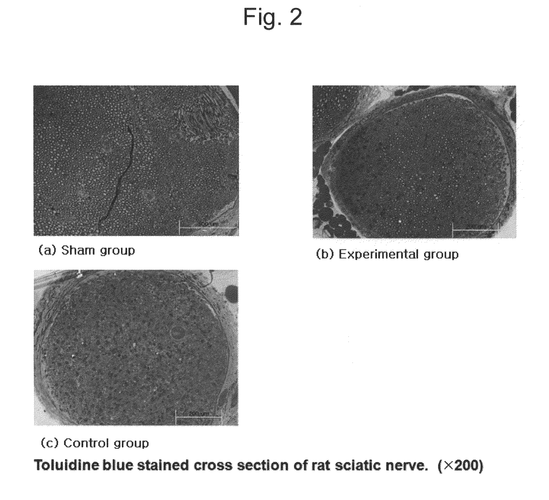 Method for treating pain induced by traumatic peripheral nerve injury by administration of G-CSF