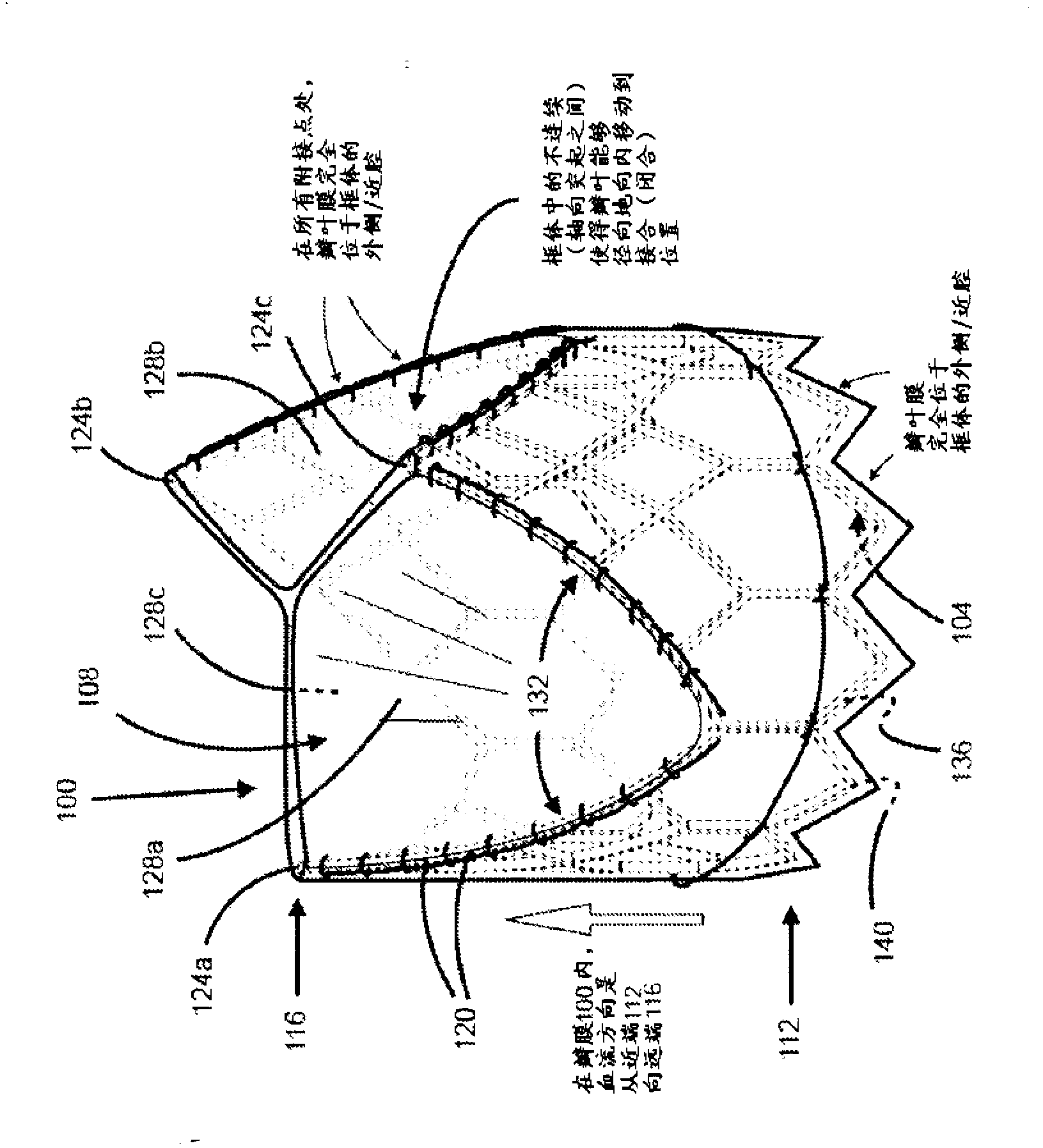 Percutaneously deliverable heart or blood vessel valve with frame having abluminally situated tissue membrane