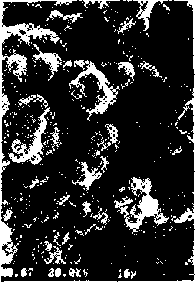 Dicalcium silicate coating layer-titanium alloy loading bone replacement material and its preparation method