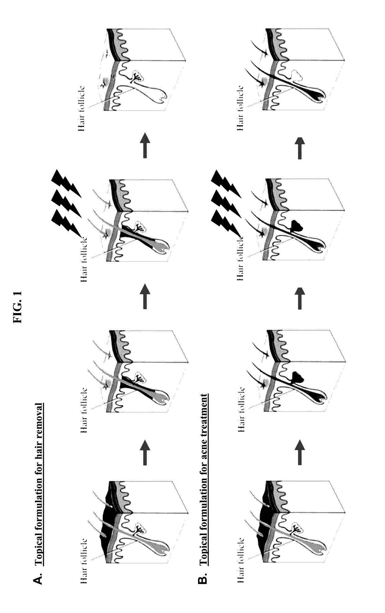 Ultrasound delivery of nanoparticles