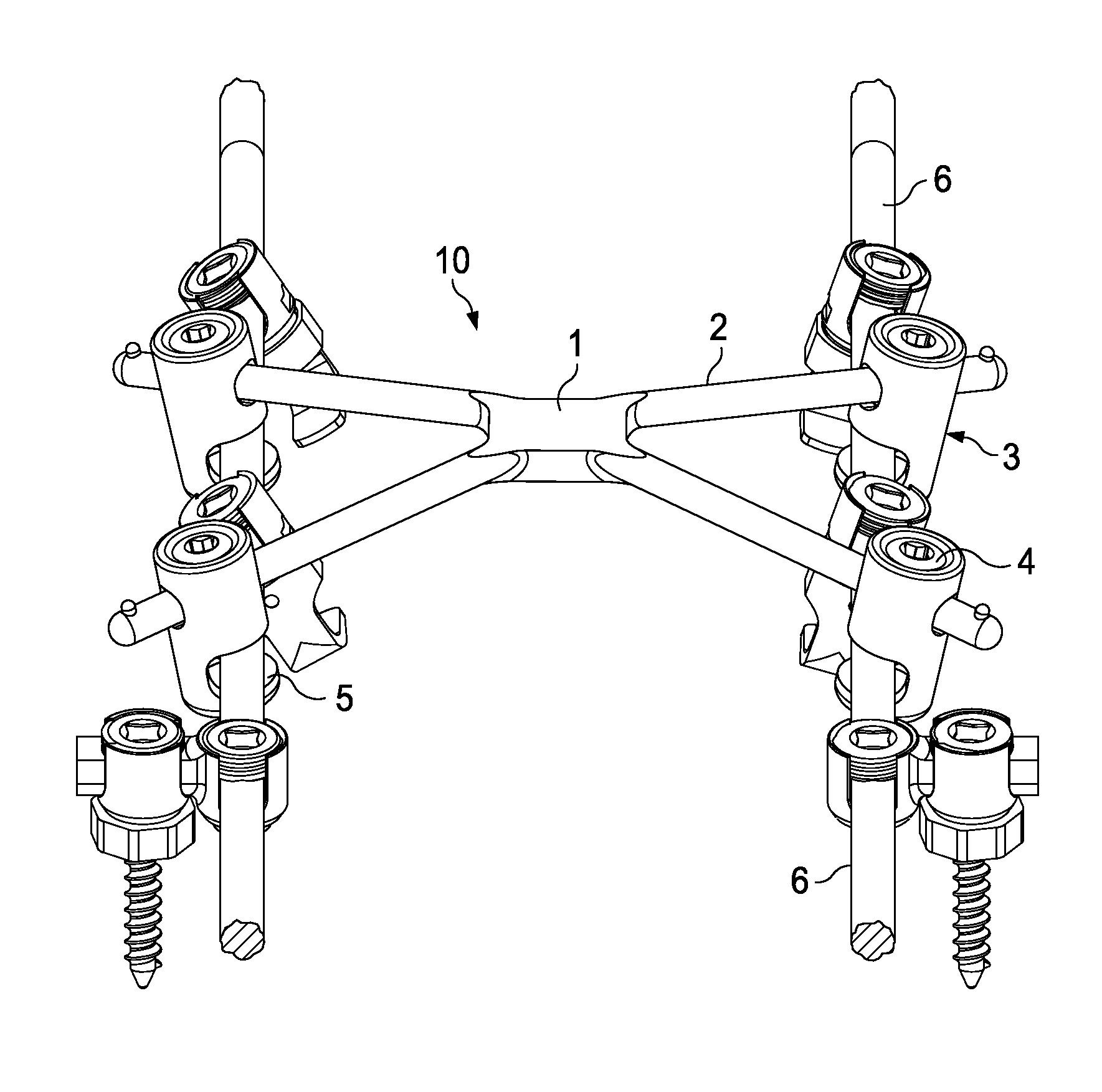 Cross-braced bilateral spinal rod connector