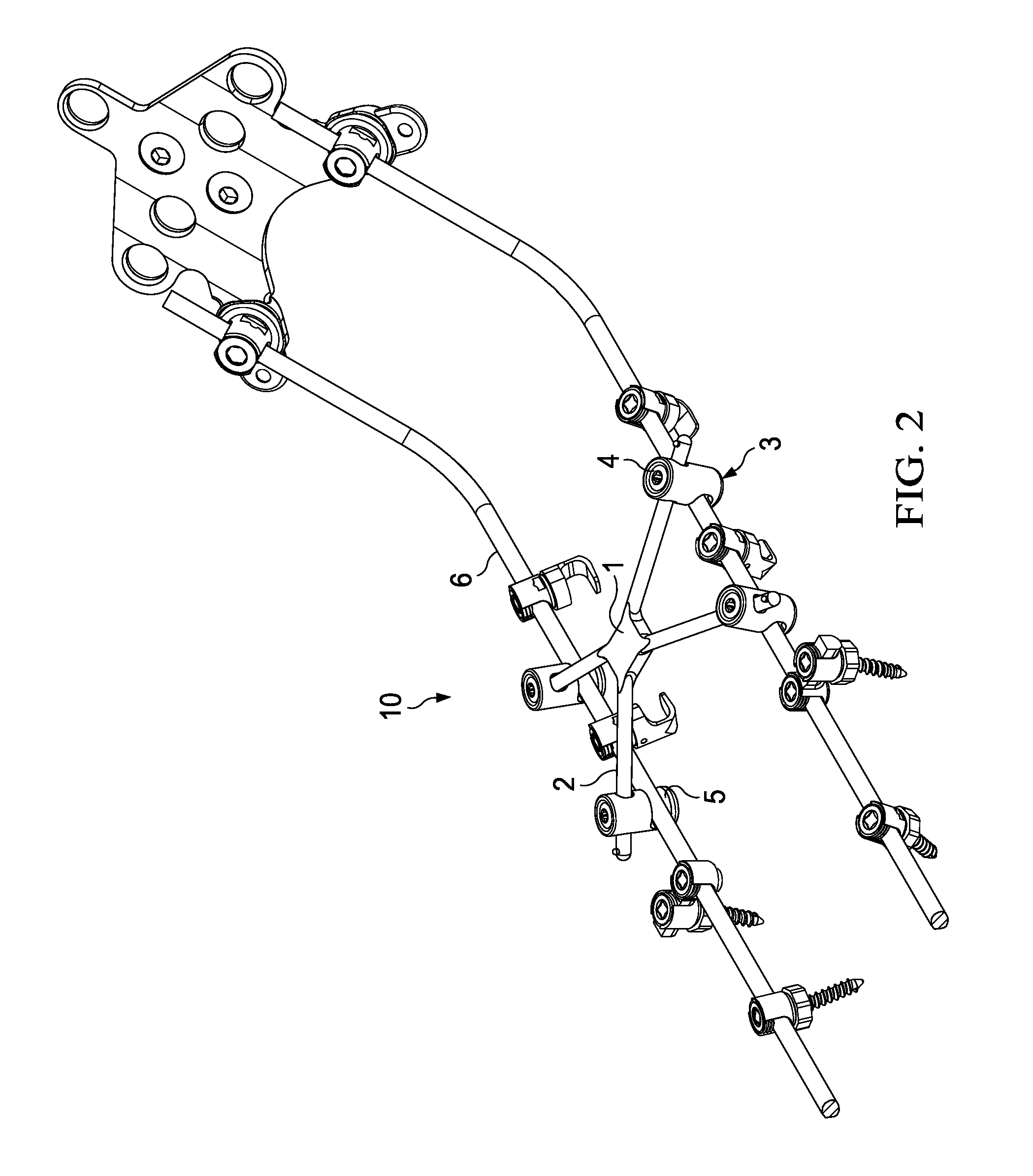 Cross-braced bilateral spinal rod connector