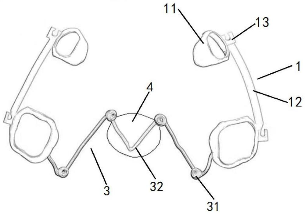 Device for distally moving posterior dentition