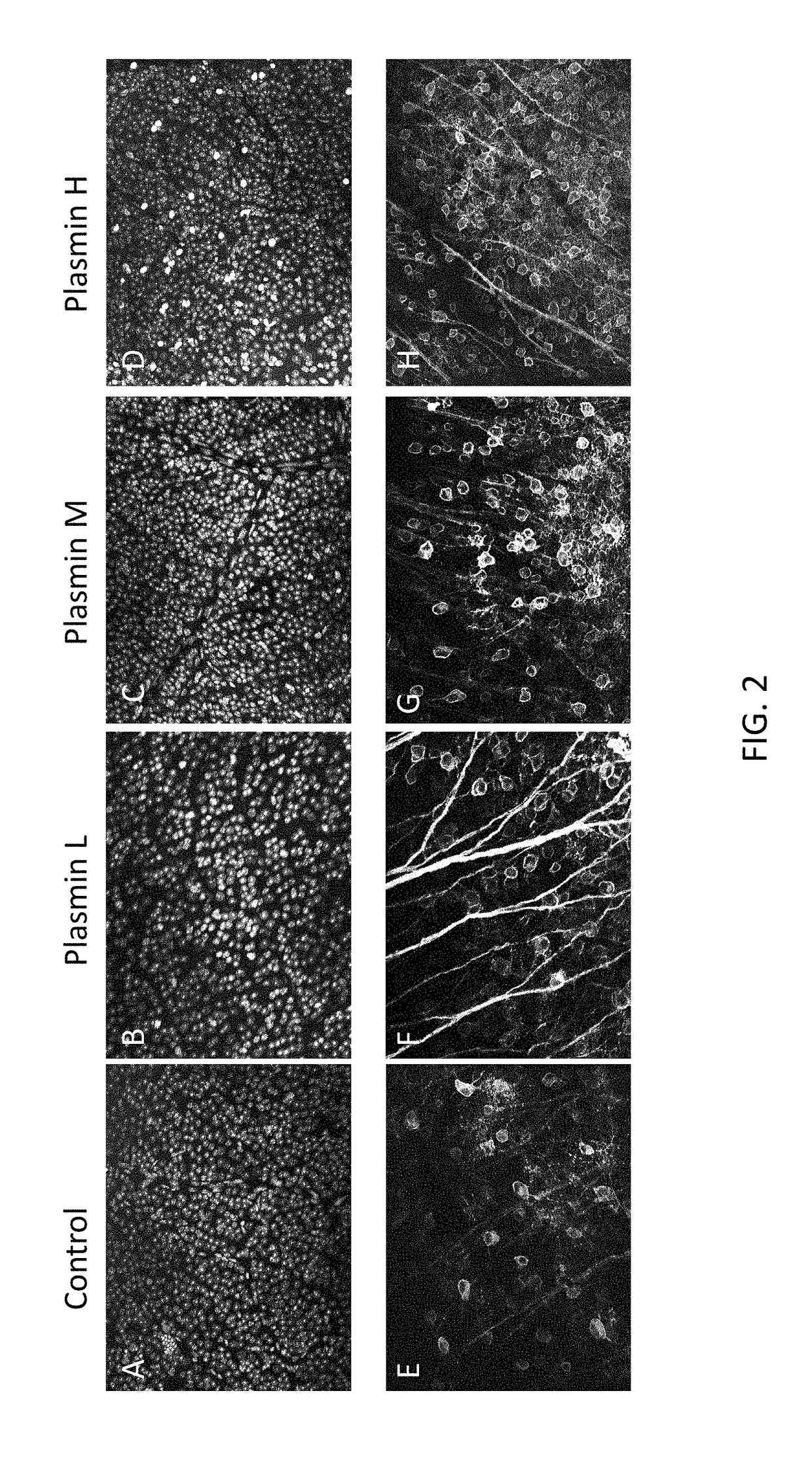 Method of Enhancing Delivery of Therapeutic Compounds to the Eye