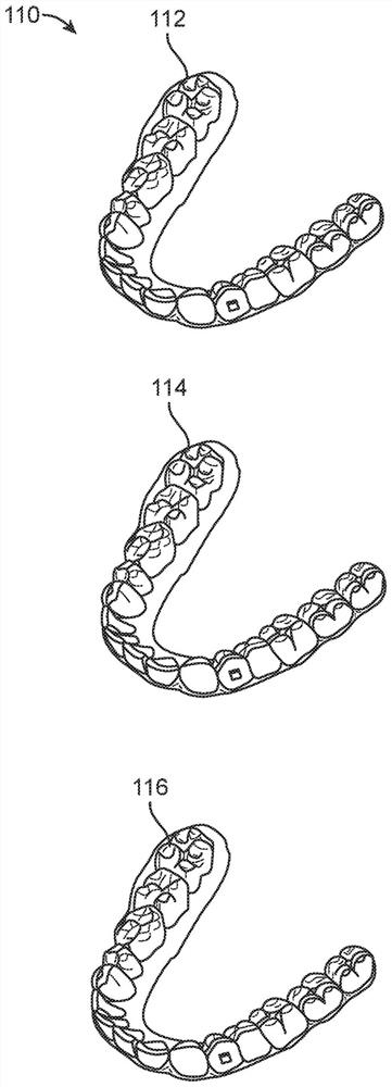 System, method and device for correcting malocclusion