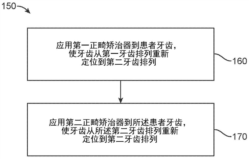 System, method and device for correcting malocclusion