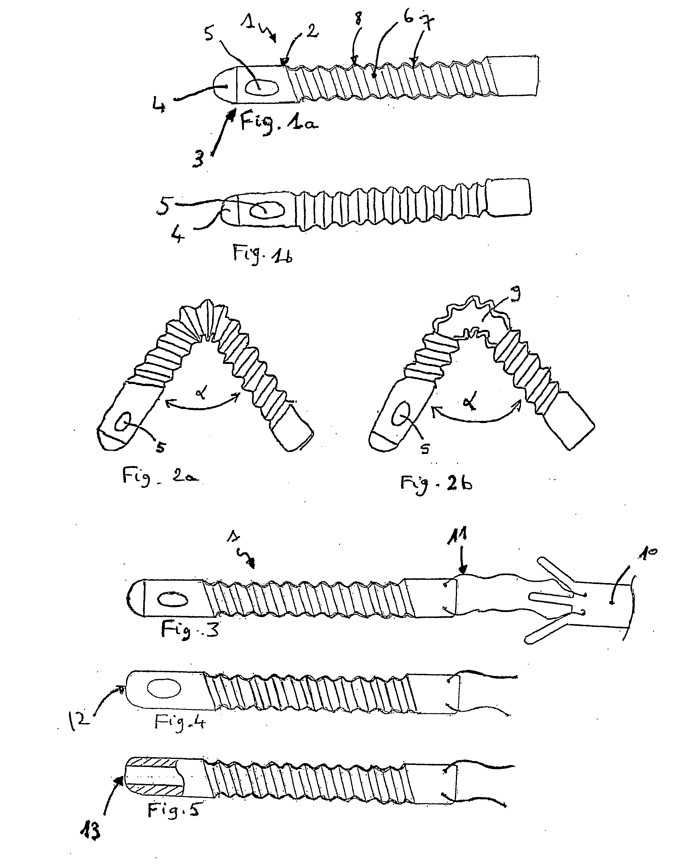 Prostatic stent