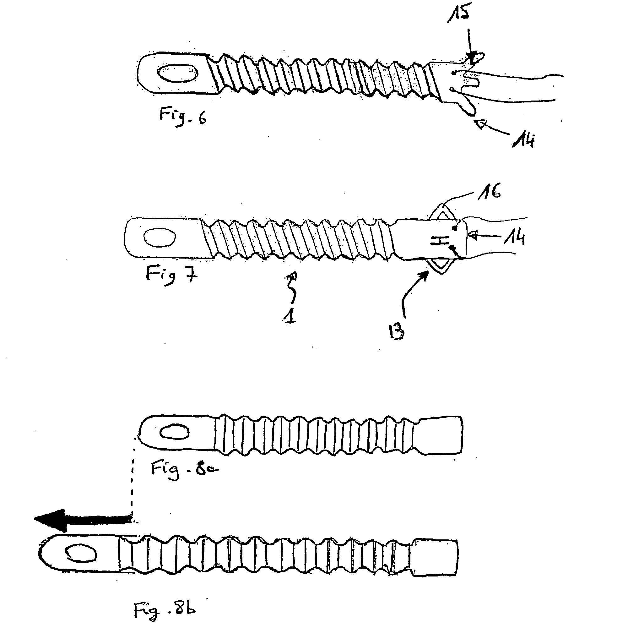 Prostatic stent