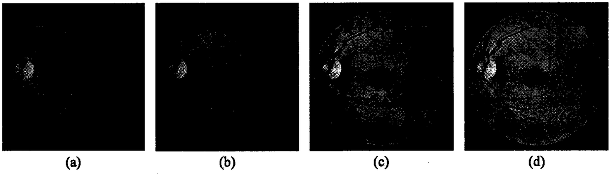 FCN retina image blood vessel segmentation through combination of depth separable convolution and channel weighing