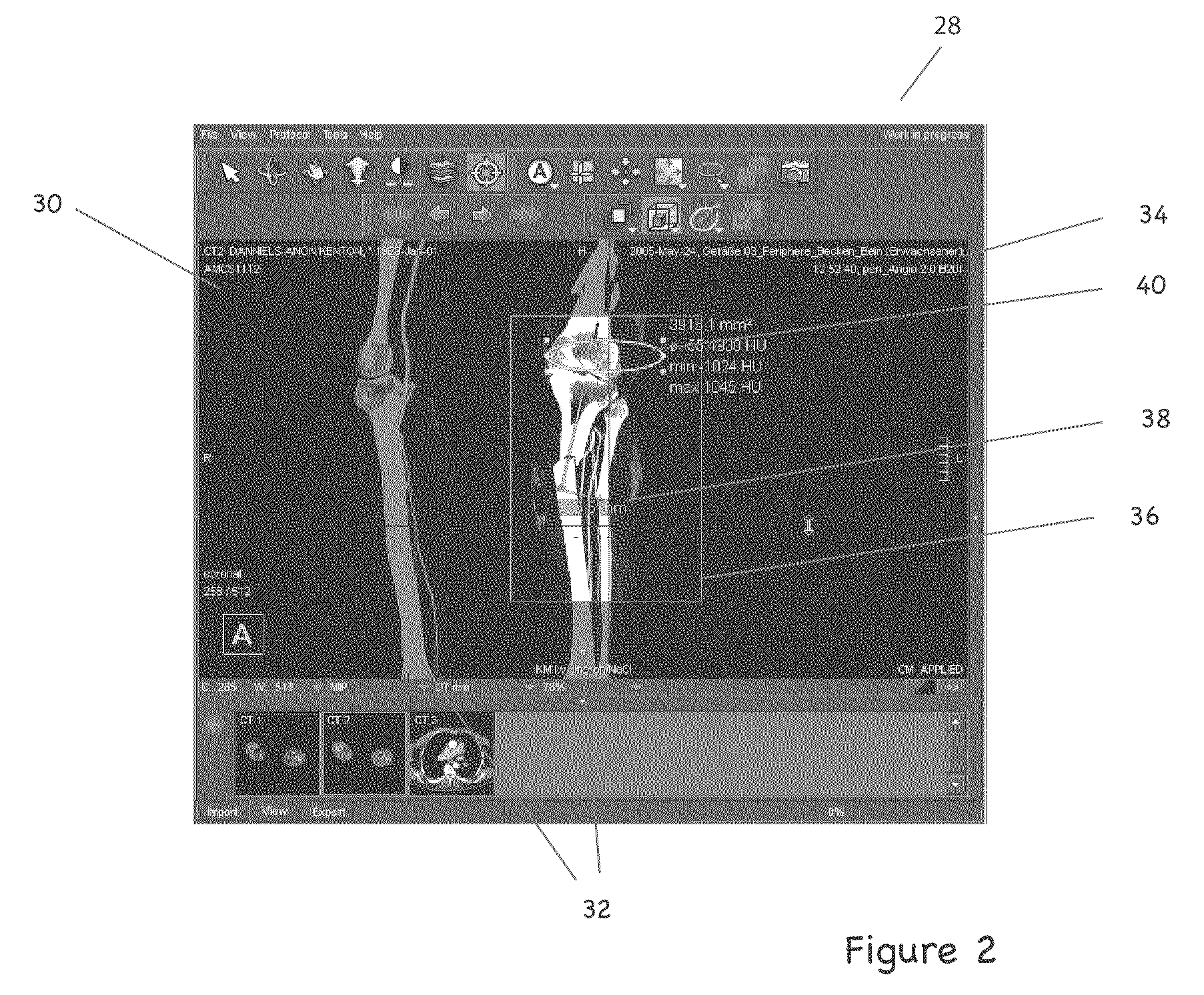 Client-server visualization system with hybrid data processing