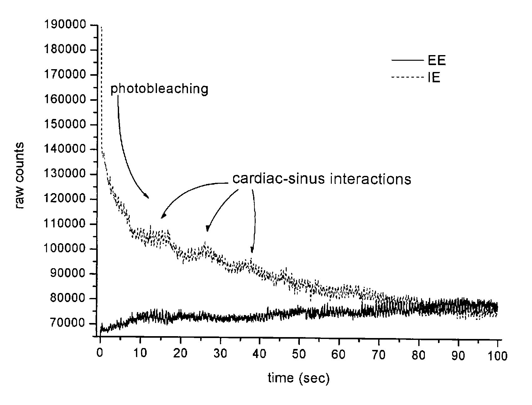 Process and apparatus for non-invasive, continuous in vivo measurement of hematocrit