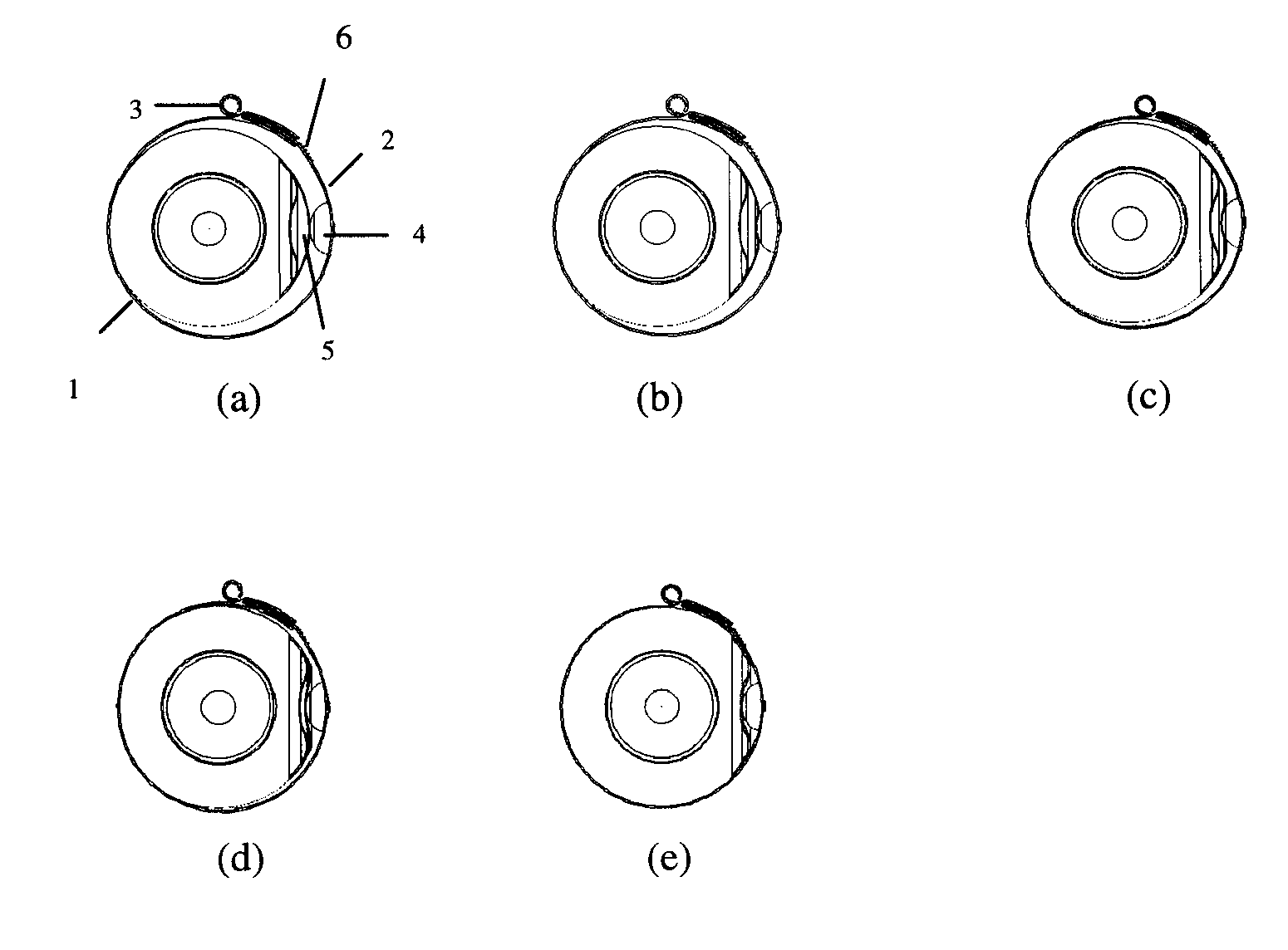 Heat Shrink Scleral Band With Custom-Made Buckle For Retinal Detachment Surgery