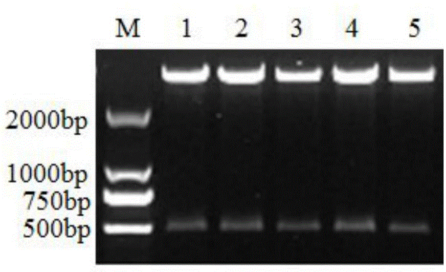 Construction and application of GADD45betaRNA interference report vector based on EGFP