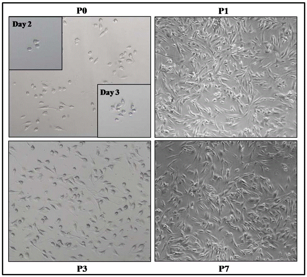 A method for inducing and culturing urinary-derived pluripotent stem cells by small molecules in vitro