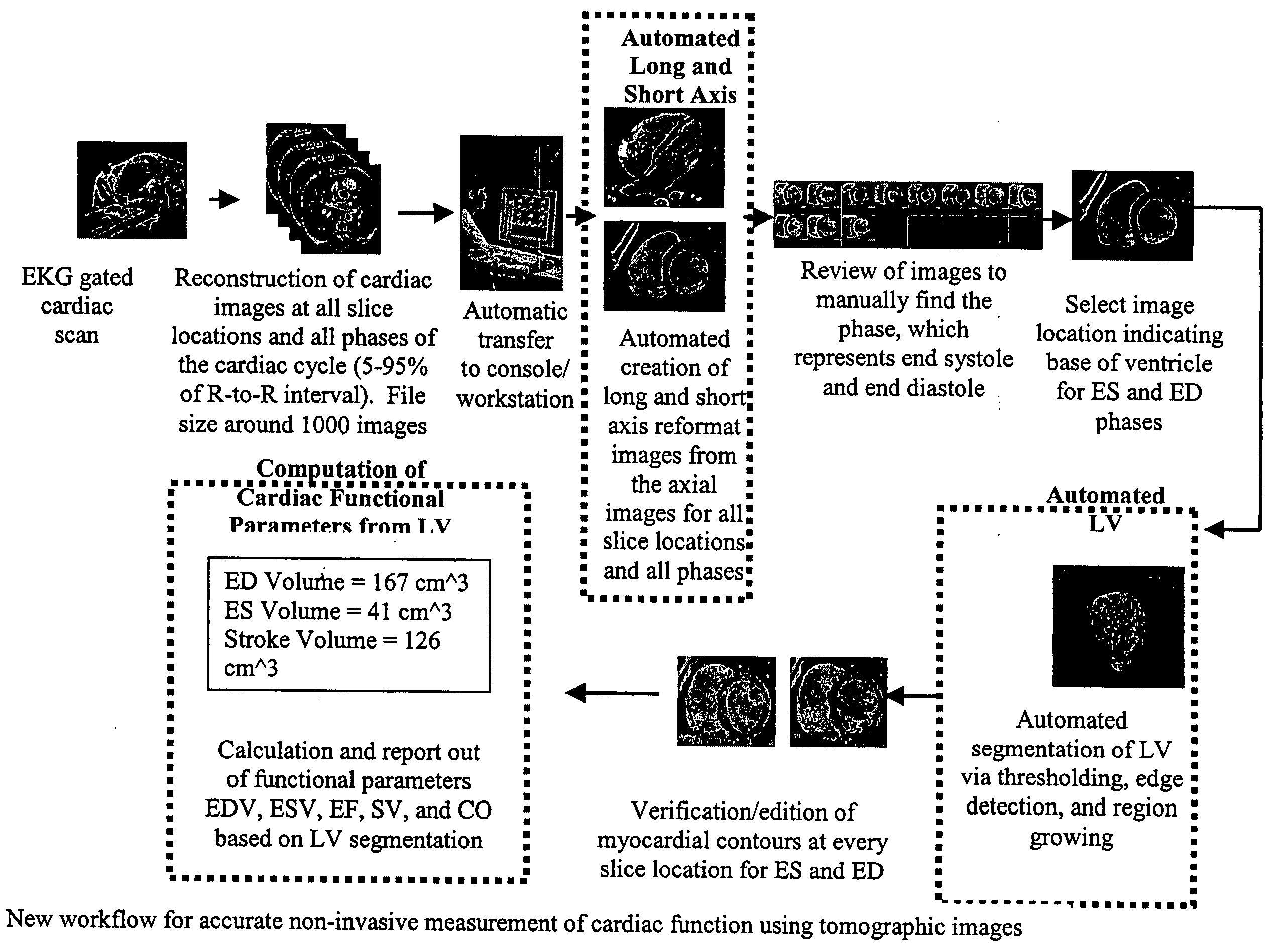 Cardiac display methods and apparatus