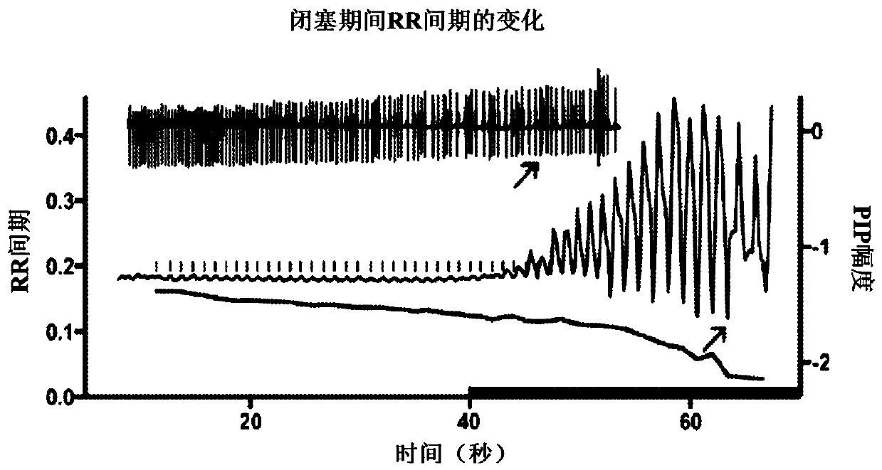 System, method and biomarkers for airway obstruction