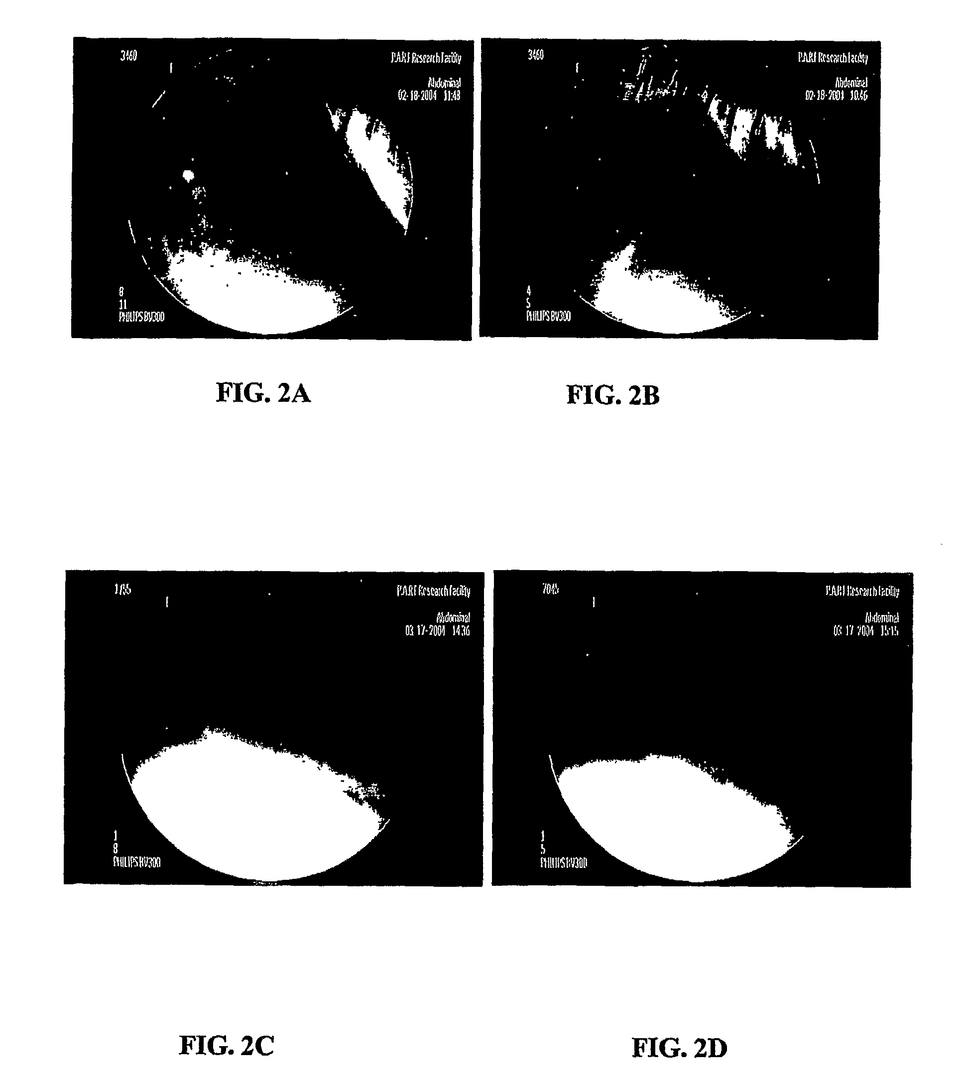 Multi-Layer Tablets and Bioadhesive Dosage Forms