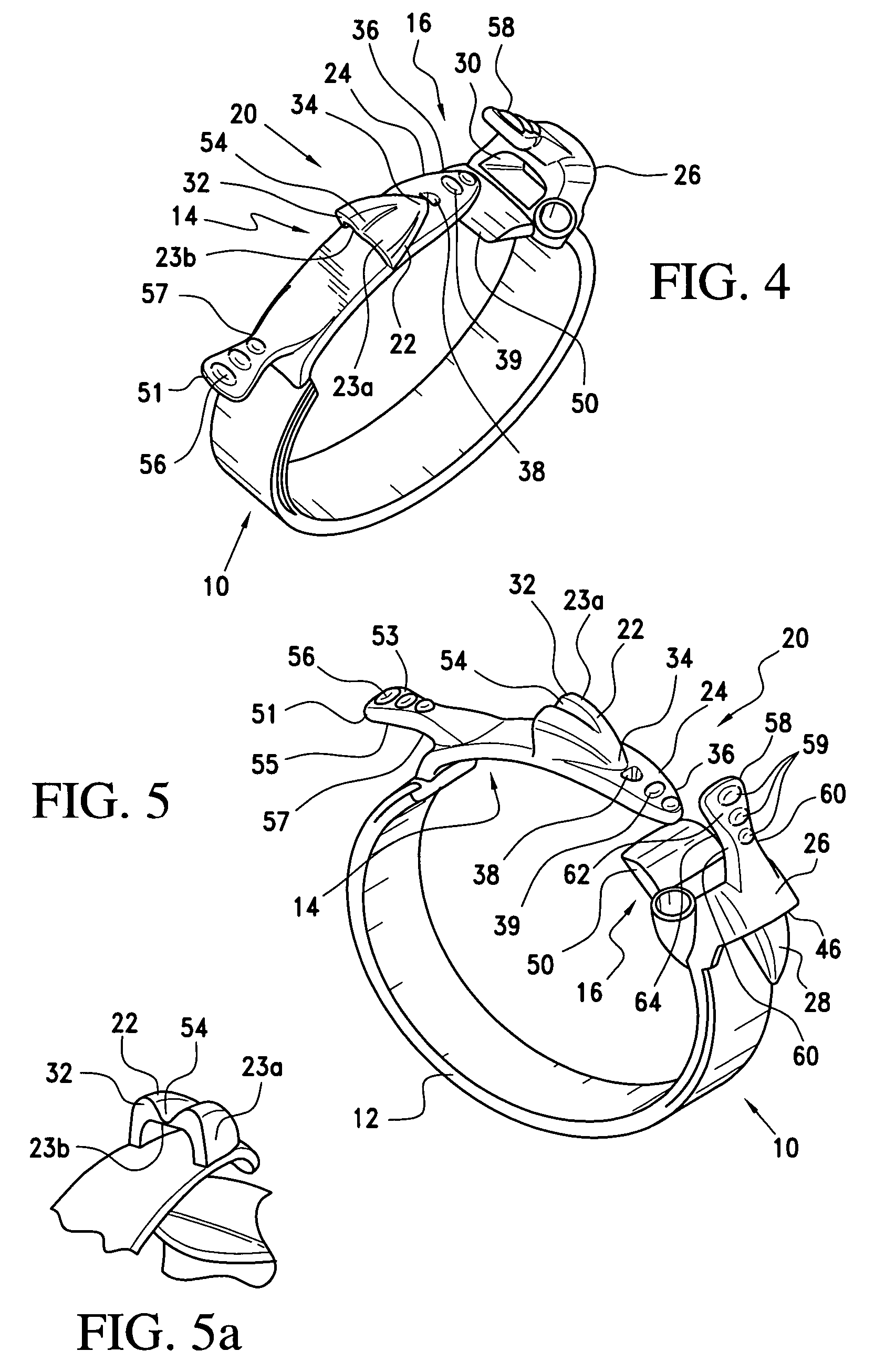 Gastric band