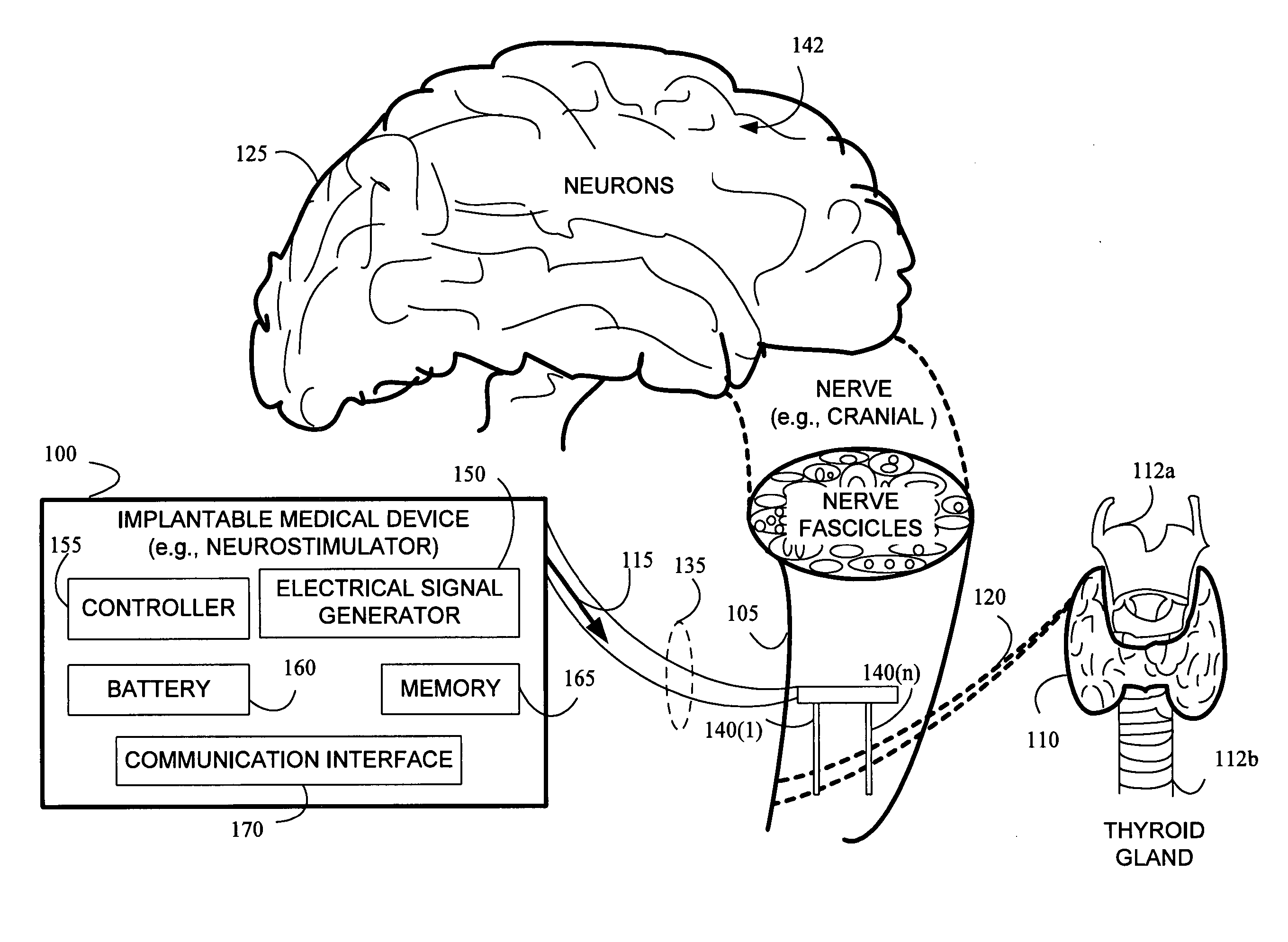 Stimulating cranial nerve to treat disorders associated with the thyroid gland