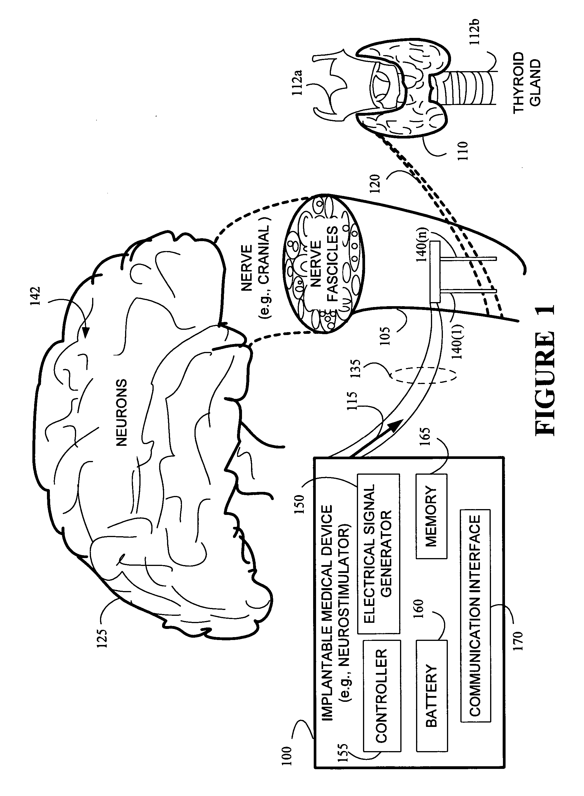 Stimulating cranial nerve to treat disorders associated with the thyroid gland