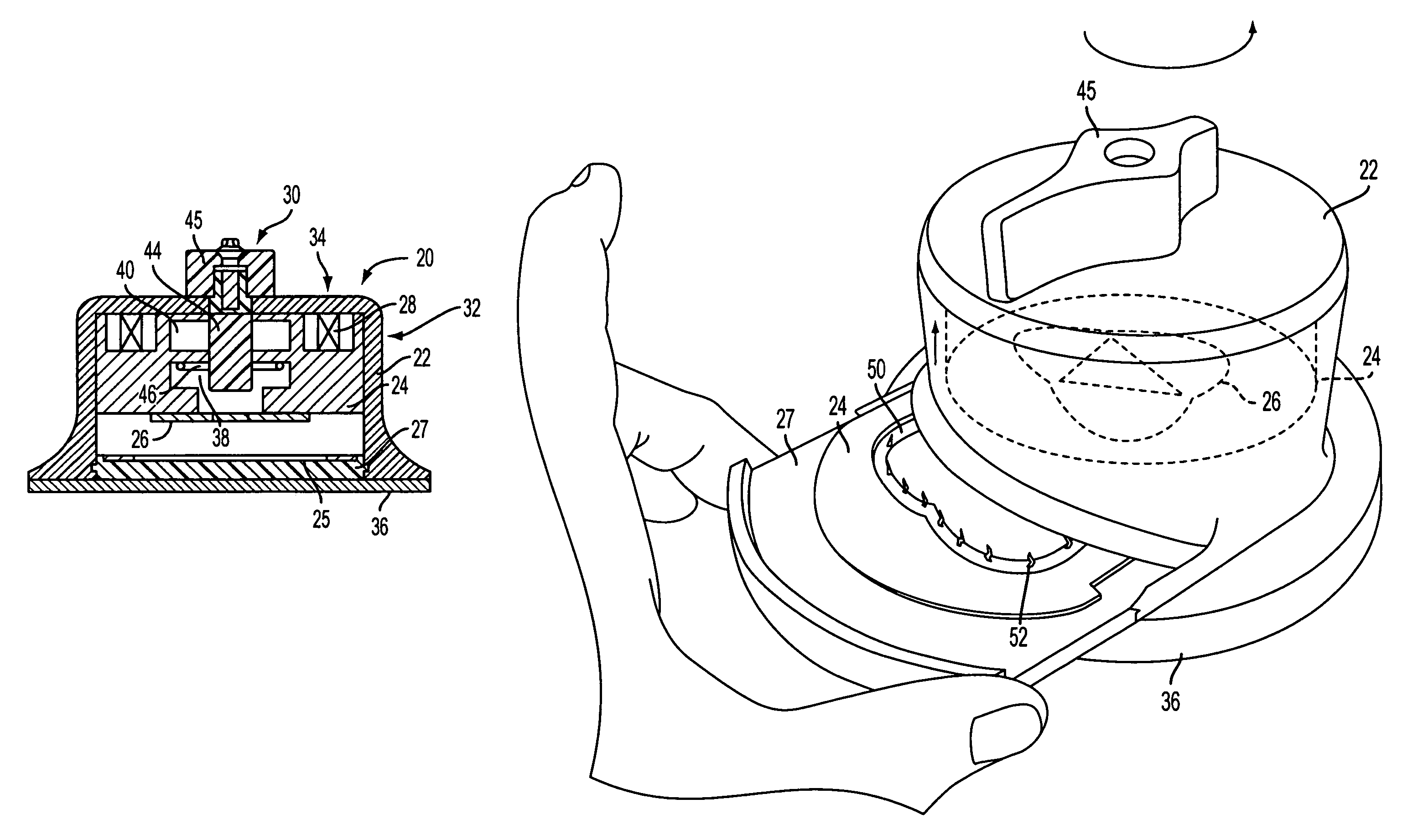 Surgical cutting device