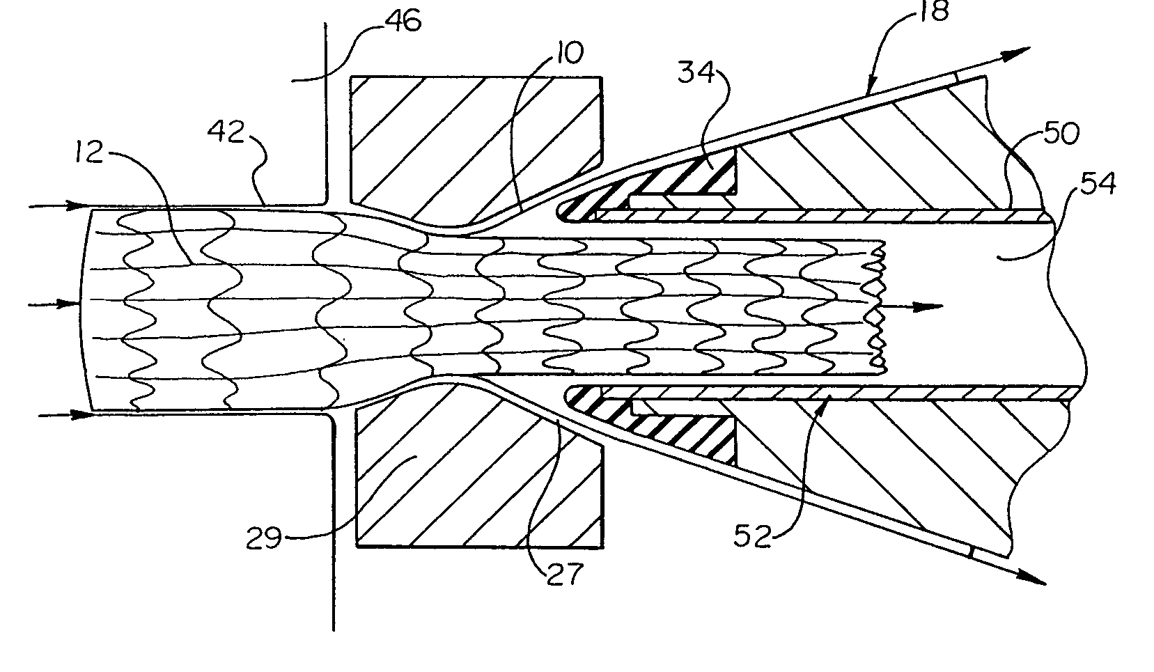 Protective loading of stents