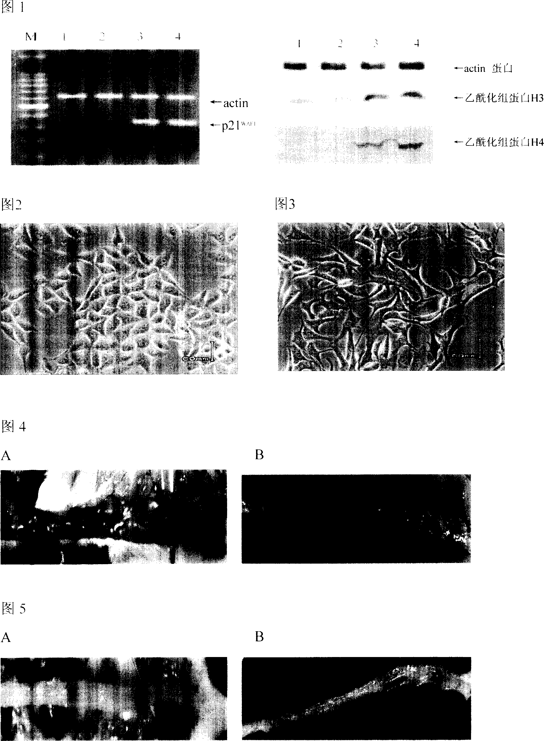 Medicinal composition for preventing and curing stomach and intestine tumor through epigenetic modification