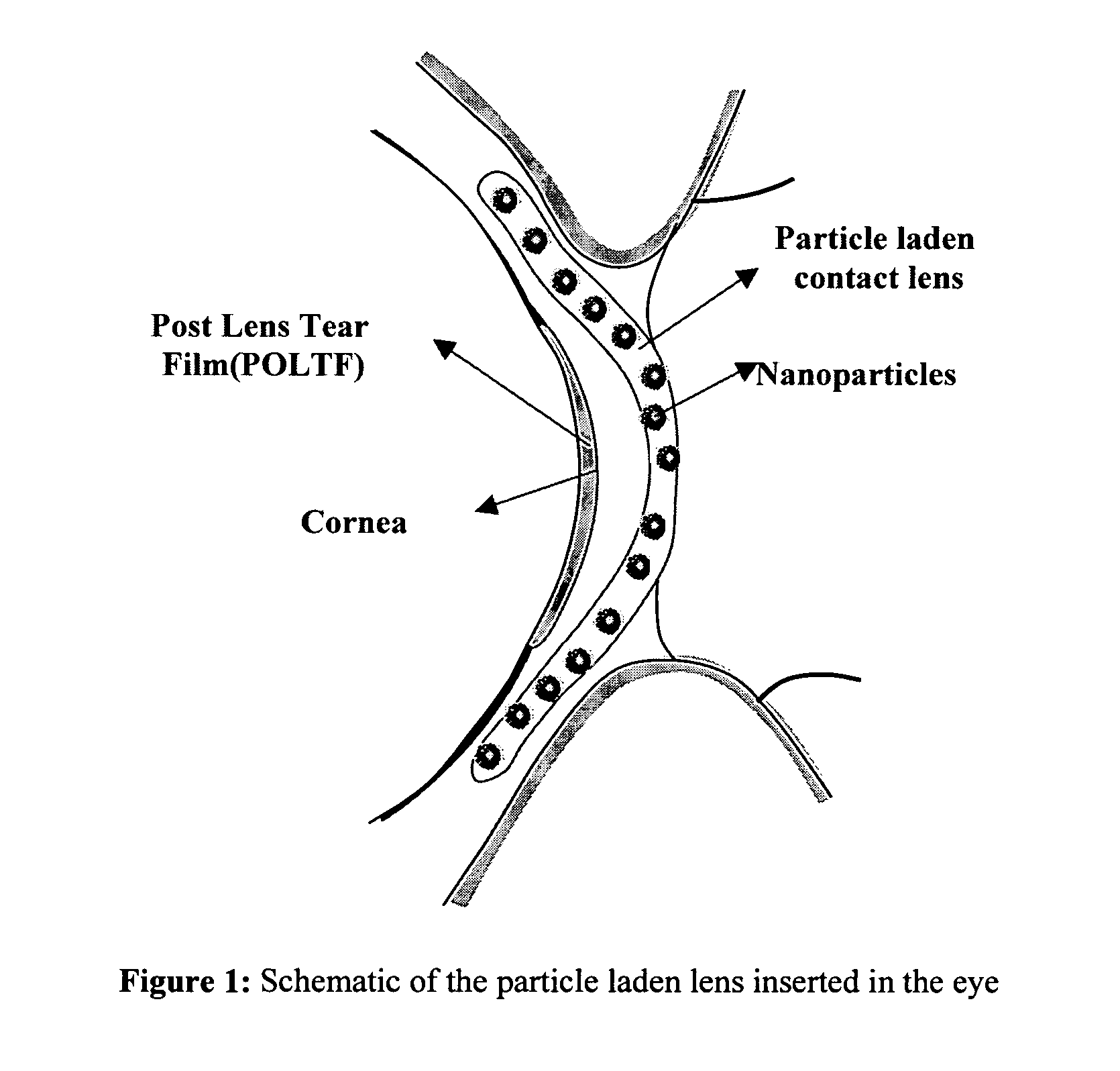 Ophthalmic drug delivery system