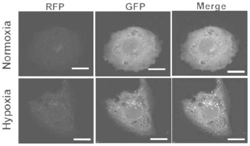 Marker gene for clinical risk assessment of preeclampsia and application of marker gene