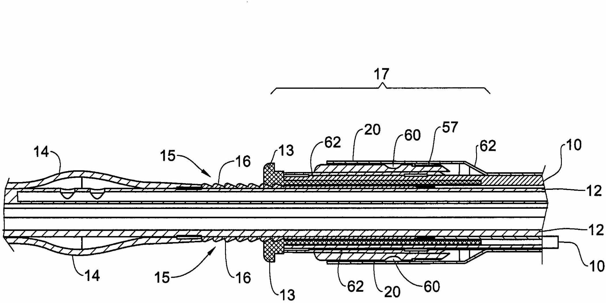 Urethral anastomosis device